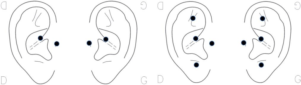 schéma acupression relaxation