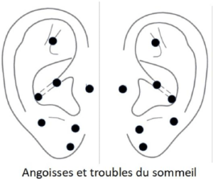 schéma acupression angoisse